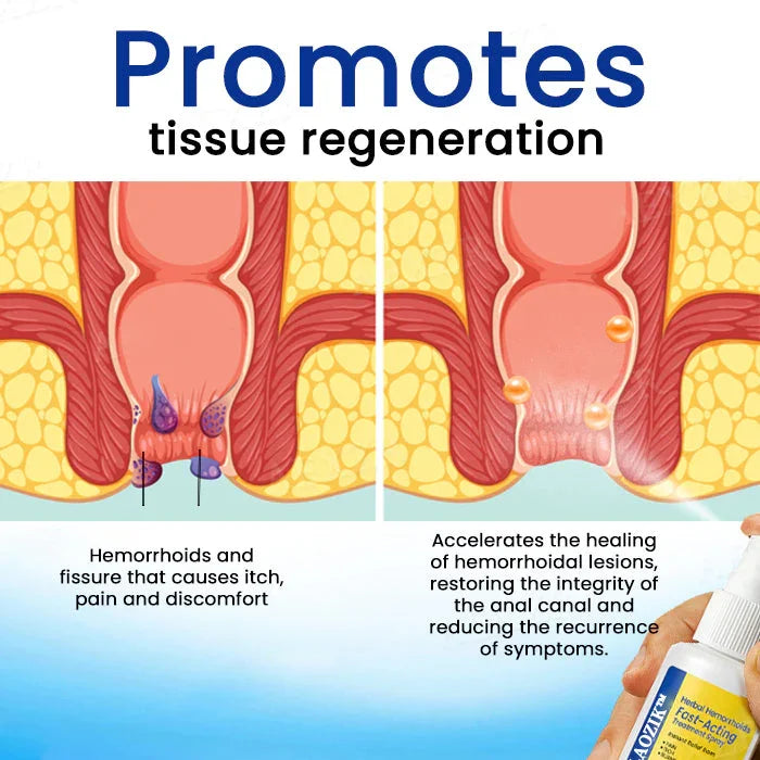 LAOZIK Herbal Hemorrhoids Fast-Acting Treatment Spray